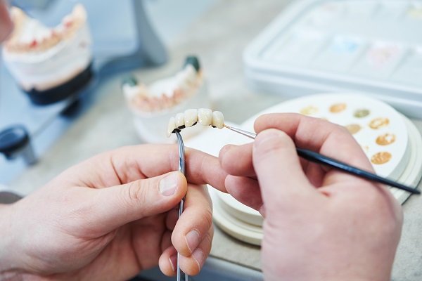 How Many Teeth Can Dental Bridges Replace?