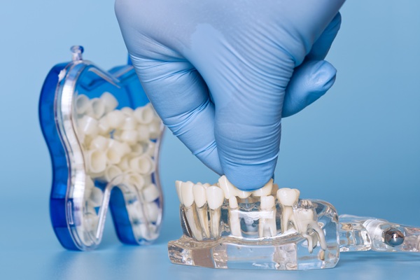 How A Dental Bridge Restores Your Smile And Improves Everyday Function