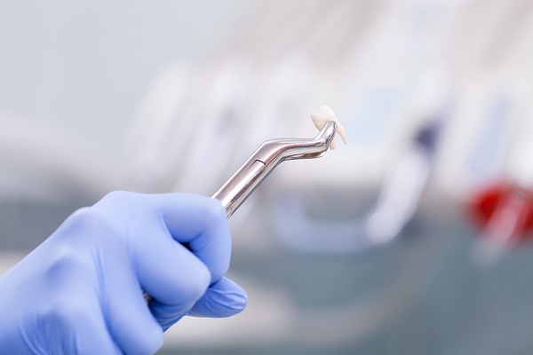 When A Dental Emergency May Require Tooth Extractions