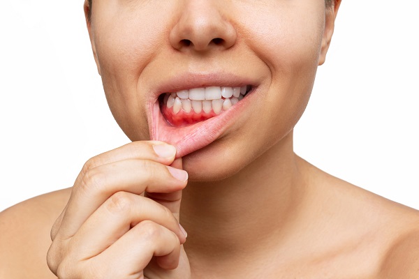 Is Gum Disease Preventable?