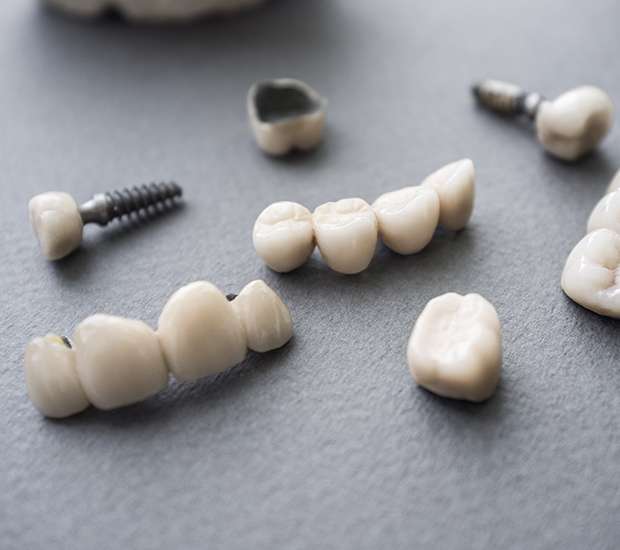 La Puente The Difference Between Dental Implants and Mini Dental Implants