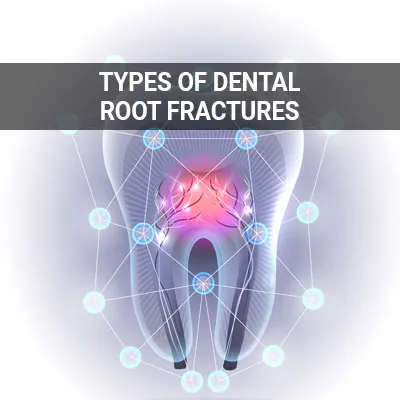 Visit our Types of Dental Root Fractures page